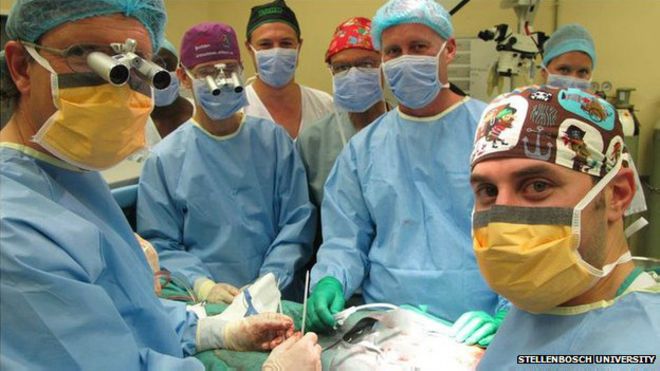 Mdicos sul-africanos afirmam ter feito primeiro transplante