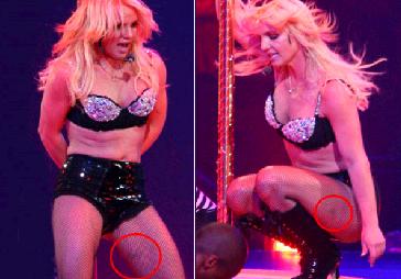 Durante show, Britney Spears exibe manchas na perna