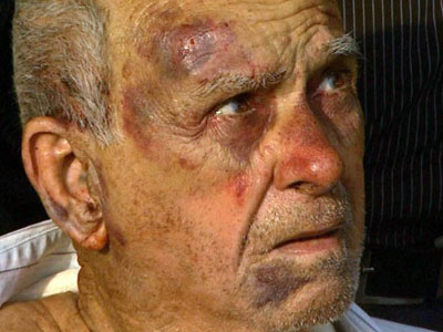Ladro pede gua e espanca homem de 88 anos em Ribeiro Preto, SP