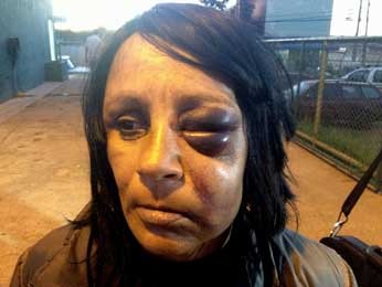 Casal diz ter sido agredido na rua por policiais no Distrito Federal