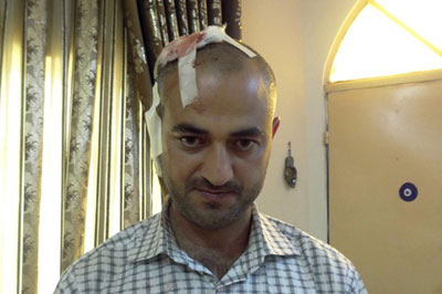 Jornalista fica gravemente ferido ao cobrir atentados no Iraque