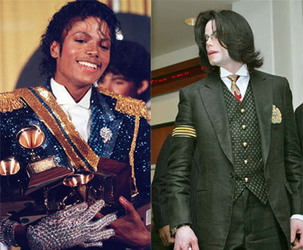 Vitiligo explicaria mudana da cor da pele de Michael Jackson