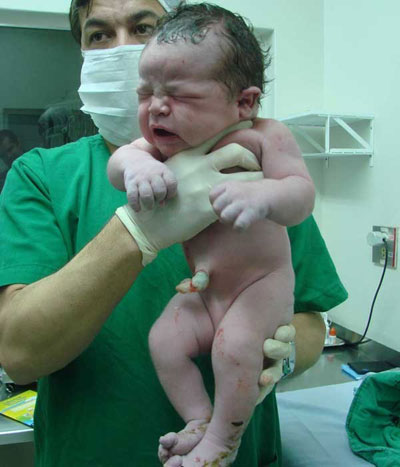 Beb de 5,2 kg passa bem, mas continua internado em Uberlndia, MG