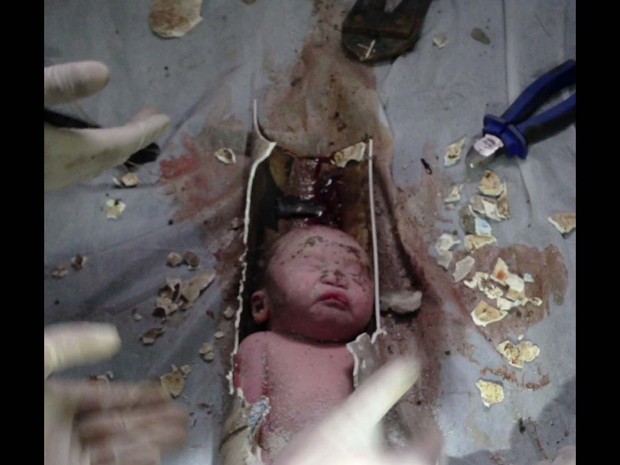 Beb resgatado na China passou de duas a trs horas preso em cano