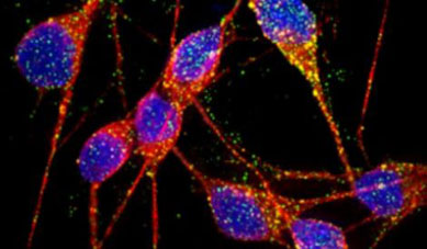 Cientistas criam neurnios com Alzheimer a partir de clulas-tronco 