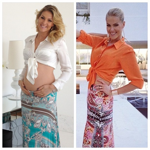 Ana Hickmann mostra antes e depois da gravidez: 
