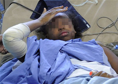 Garota que sobreviveu a queda de avio em Comores est consc - sobrevivente. a 310
