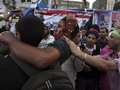 Sobe para 75 o nmero de mortos em protesto pr-Morsi