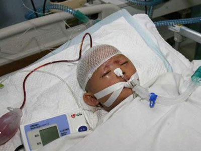 Menina atropelada duas vezes e no socorrida morre no hospital na China