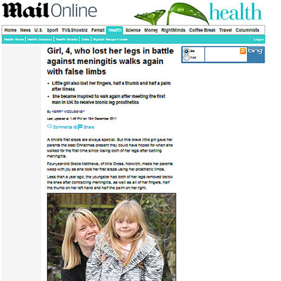Menina de 4 anos que perdeu pernas para meningite anda pela 1 vez