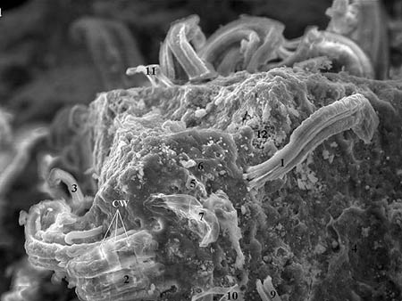A bactria e a polmica