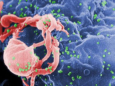 Plula 4 em 1 torna tratamento do HIV mais 