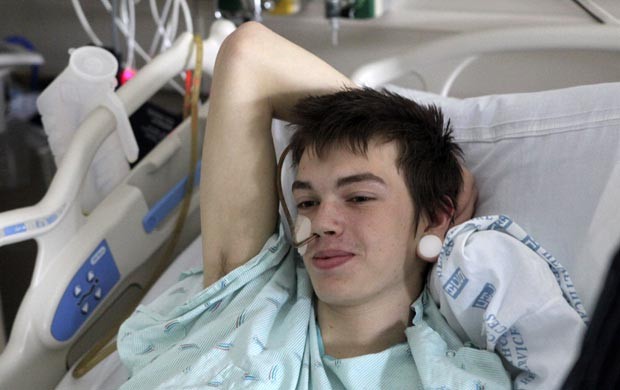 Adolescente  hospitalizado aps engolir cerda de escova de metal