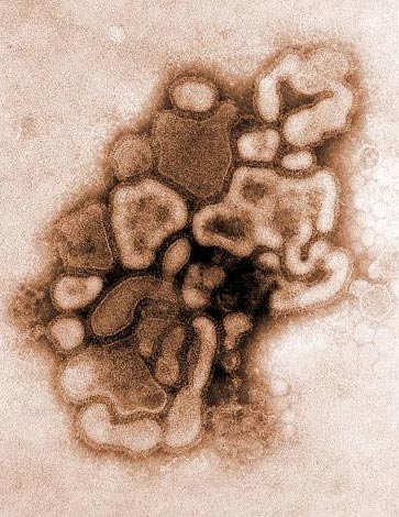 Confirmao de morte por gripe suna fora do Mxico no muda alerta