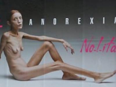 Modelo Isabelle Caro que lutava contra anorexia morre na Frana