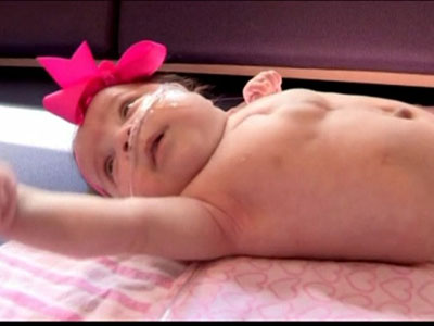 Beb que nasceu com parte do corao fora do corpo deixa hospital