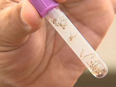 Mais 59 casos de dengue so confirmados em Bauru, SP