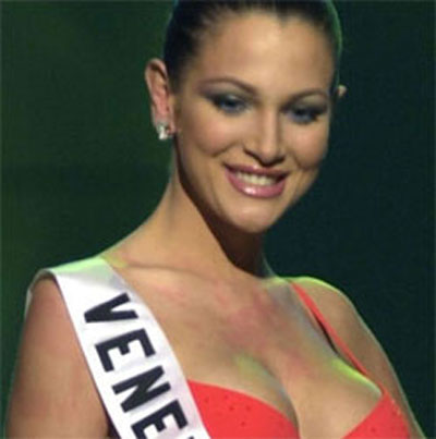 Ex-Miss Venezuela morre de cancro da mama aos 28 anos.