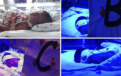 Mulher d  luz dois pares de gmeos idnticos em hospital dos EUA