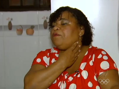 Mulher vive h mais de 30 anos  com agulha atravessada na garganta
