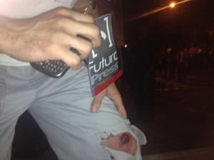 Protestos em Guarulhos fecham a Dutra e deixam feridos no Centro