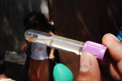 Pesquisa aponta subnotificao de dengue em Santos 