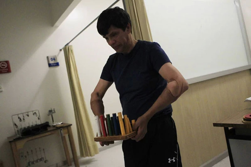 Mexicano que passou por transplante de braos faz reabilitao em hospital