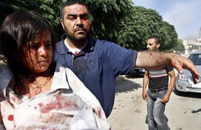 Civis srios feridos em bombardeio so hospitalizados na Turquia