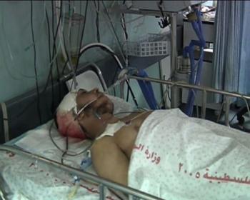 Ataques israelenses provocam caos nos hospitais de Gaza