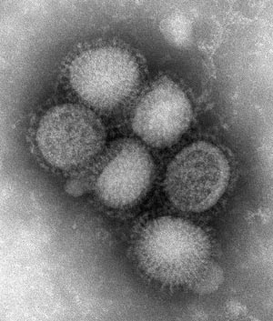 Frana cancela pedido de 50 milhes de doses da vacina anti H1N1 