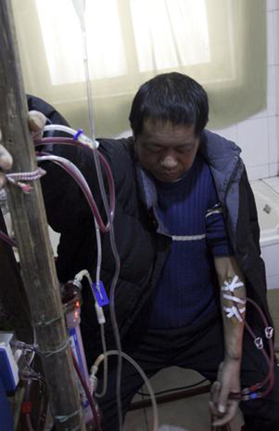 Sem dinheiro para tratamento, chins cria mquina de hemodilise  