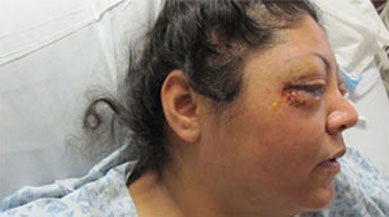 Policial  acusado de cegar mulher com spray de pimenta na Califrnia