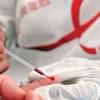 Infeco por HIV inibe casos graves de H1N1, segundo estudo 
