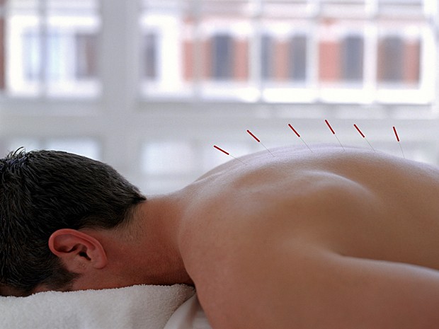 Psiclogos no podem aplicar acupuntura em pacientes, decide STJ