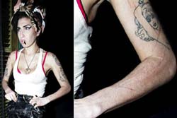 Amy Winehouse aparece com os braos arranhados.